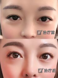 -亿美医疗美容·半岛大超炮官方授权店