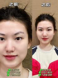 -四川娇点医学美容医院