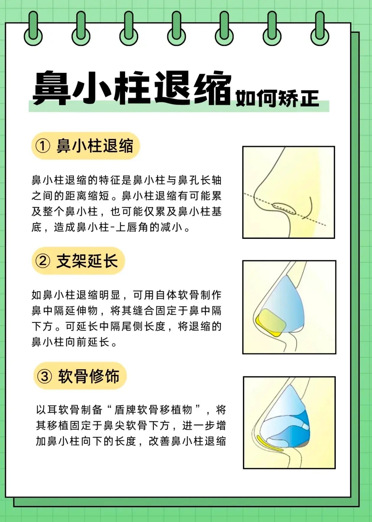 鼻小柱退缩如何矫正?