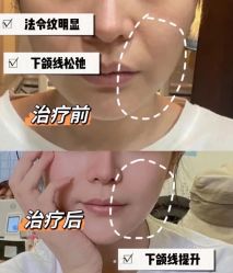 -深圳阳光医疗美容