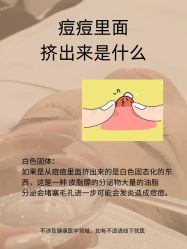-克丽缇娜