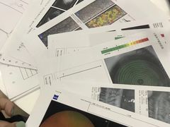 -上海大学附属上海和平眼科医院
