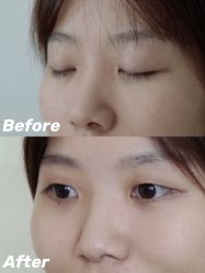 -美壹生诊所皮肤管理中心·海菲秀&Legacy美白舱