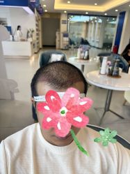 -大麦微针植发全国连锁