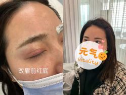 -MIVI半永久纹眉绣眉