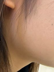 -长沙雅美医疗美容医院