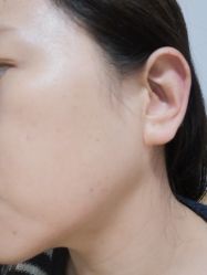 -新美荟医美·专注面部美学抗衰