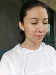 体验后-广州美莱医疗美容医院