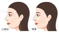 -北京米扬丽格医疗美容·联合丽格鼻整形中心