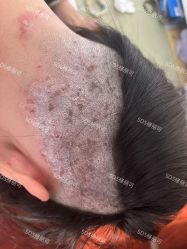 -SOS修丽可.痘肌修复中心