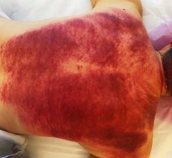 -简悦美塑·徒手点穴减肥