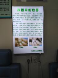 -德哥灰指甲脚气甲沟炎跖疣护理