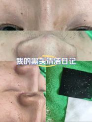 -黛颜人·清颜堂专业祛痘·皮肤管理