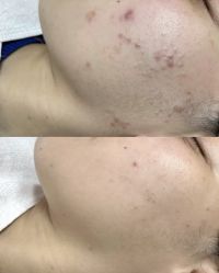 -康美贞·痘肌养护管理中心