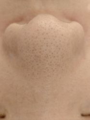 -SKIN79皮肤管理中心