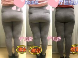 点击看大图 -产后帮产后修复(首城国际店)