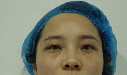 -天津健丽·去眼袋医疗美容机构