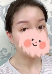 -南京健丽·去眼袋医疗美容机构