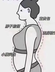-香薇妮丝女子减肥院