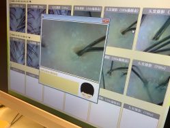 -LESSMORE科技头皮理容中心