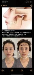 -LUNA皮相美·骨相美高级美感