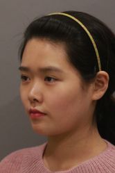 -北京米扬丽格医疗美容·联合丽格鼻整形中心