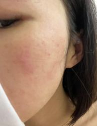 -Yestar 嘉兴艺星医疗美容医院