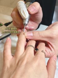 -U-Nail