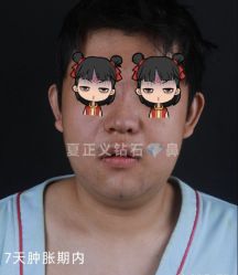 -北京米扬丽格医疗美容·联合丽格鼻整形中心
