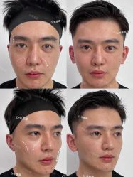 -Yestar重庆艺星医疗美容医院