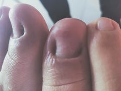 -新甲连锁灰指甲·甲沟炎·鸡眼(黑龙江路店)