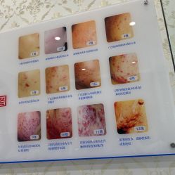 -SOR索尔祛痘·面部肌肤科学管理