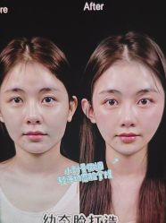 -东莞壹加壹整形美容医院