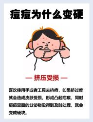 -BR光电保养