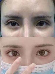 -上海漾颜医疗美容