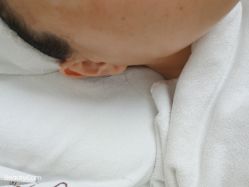 体验前-JS医疗美容