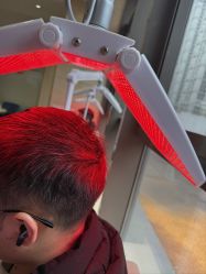 -碧莲盛·不剃发植发