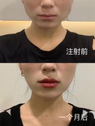 -成都西区医院整形美容