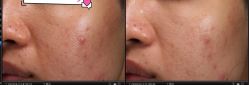 -苑苑vbeauty科技美容SPA