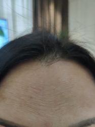 -广州美莱医疗美容医院