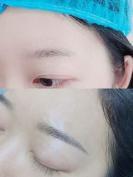 -久匠半永久纹眉