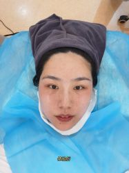 体验后-哈尔滨瑞丽医疗美容医院