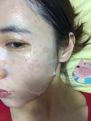 体验后-上海玫瑰医疗美容医院