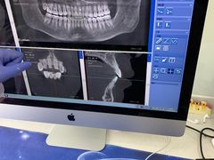 -Dr.Z dental仁康种植矫正中心