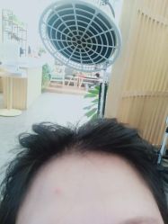 -章光101防脱养发荟