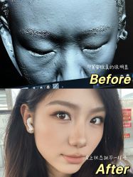 体验后-原力医疗美容