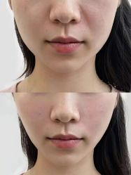 -美丽田园Beauty Farm