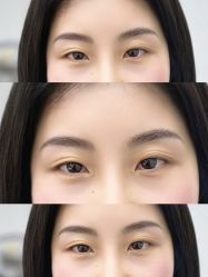 点击看大图 -Doris多里斯半永久纹眉·SMP纹发·发际线