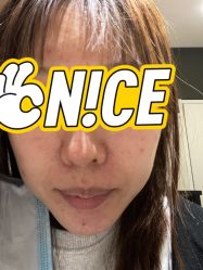 体验前-亿美医疗美容·半岛大超炮官方授权店