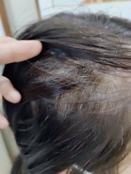 -熙朵美学植发·连锁品牌